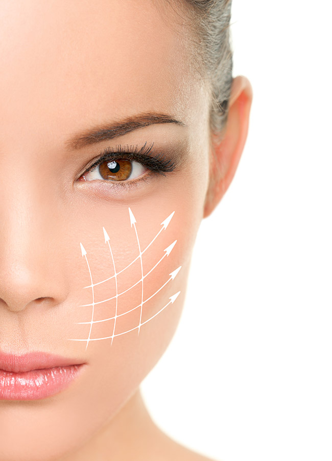 ماندگاری لیفت صورت با نخ چقدر است