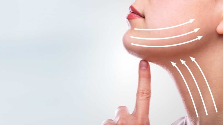 لیفت صورت با نخ بهتر است یا هایفو