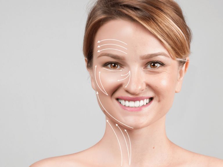 لیفت صورت با نخ برای چه سنی مناسب است؟