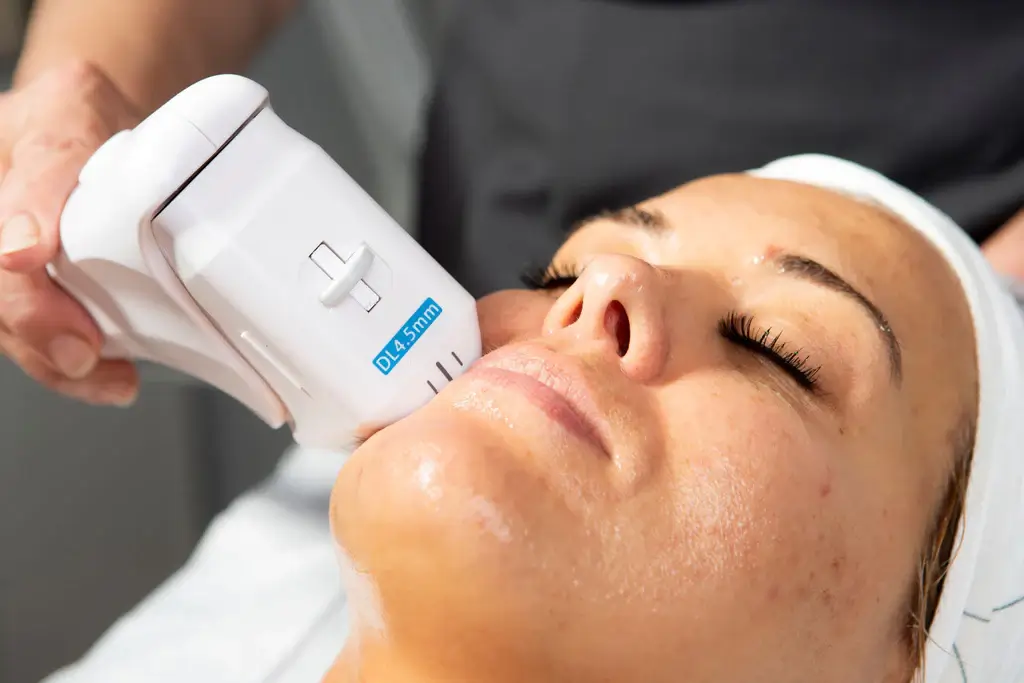 هایفو تراپی برای لیفت صورت