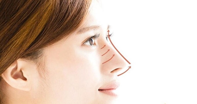 ماندگاری لیفت بینی با نخ