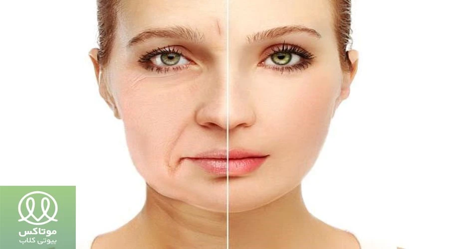 علت افتادگی پوست صورت