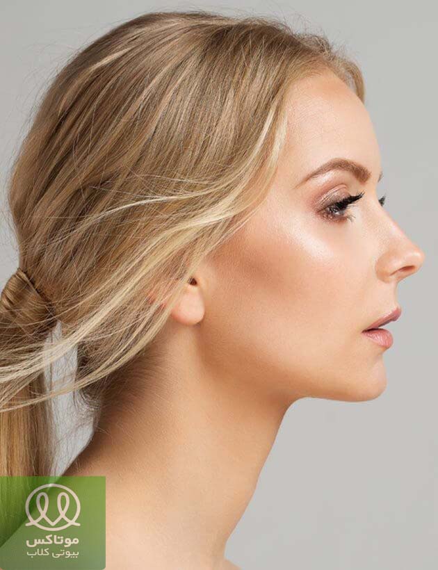 بهبود ظاهر با لیفت بینی با نخ