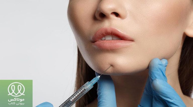 زاویه سازی فک با تزریق ژل