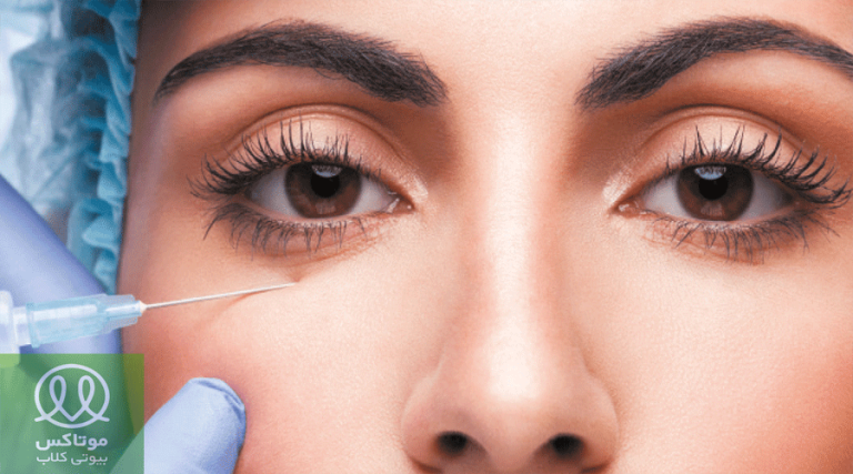 فیلر گودی چشم