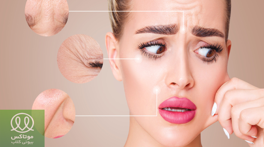 رفع چین و چروک با فیشال