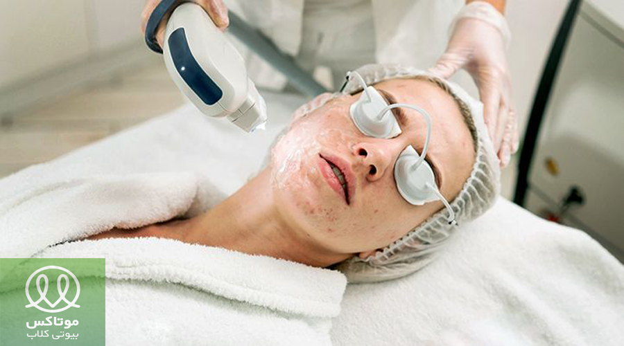 درمان اسکار با لیزر