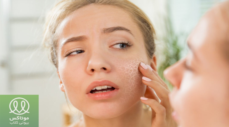 خشکی پوست در بارداری