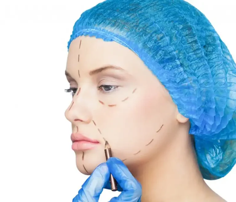 لیفت صورت با نخ چیست؟