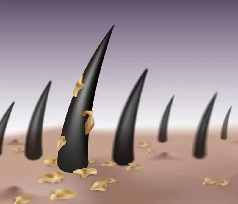 فاصله جلسات بین لیزر موهای زائد باید چقدر باشد؟