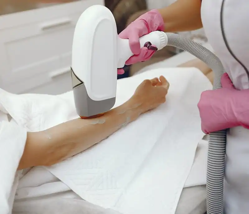 کاهش دائمی موهای زائد