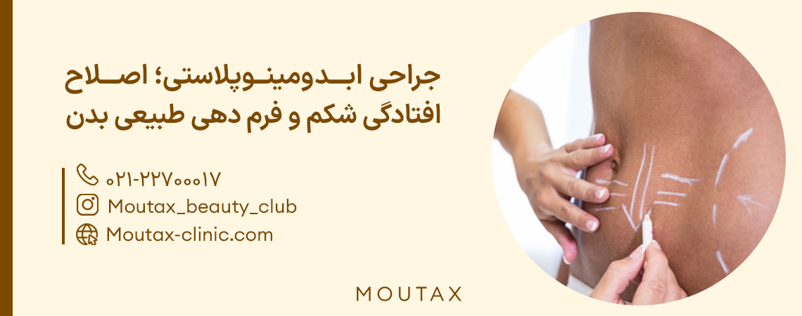 عمل زیبایی شکم