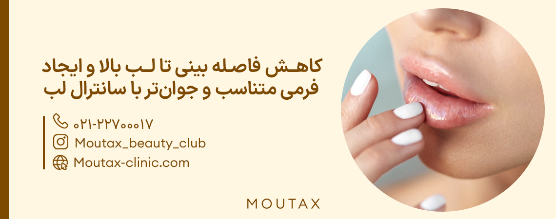 لیفت سانترال لب