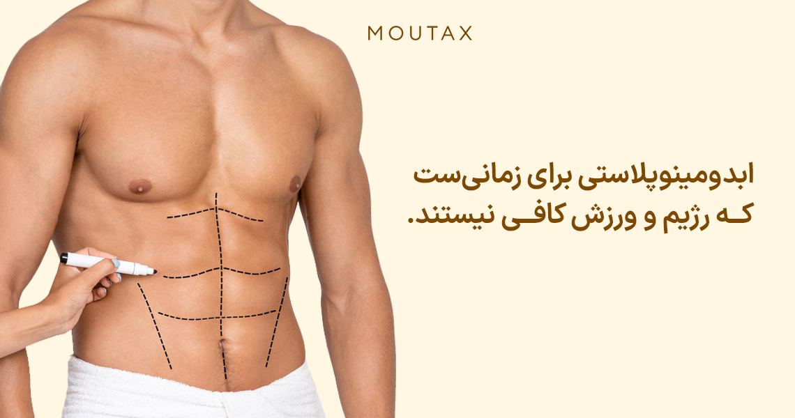 جراحی ابدومینوپلاستی