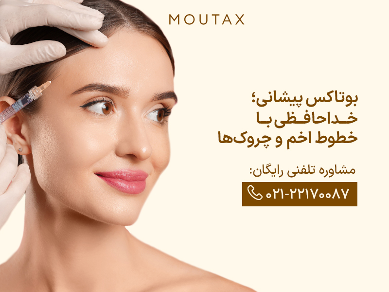تزریق بوتاکس به پیشانی