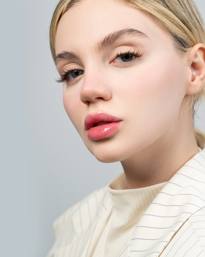 لیفت شقیقه با نخ