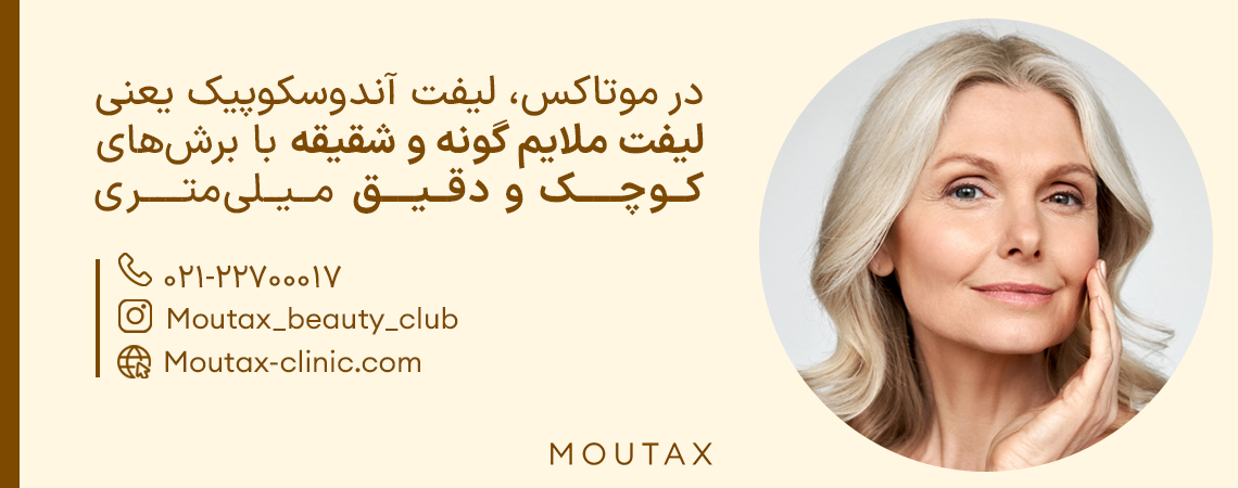 جراحی آندوسکوپی صورت