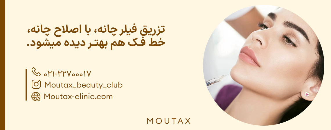 تزریق ژل چانه