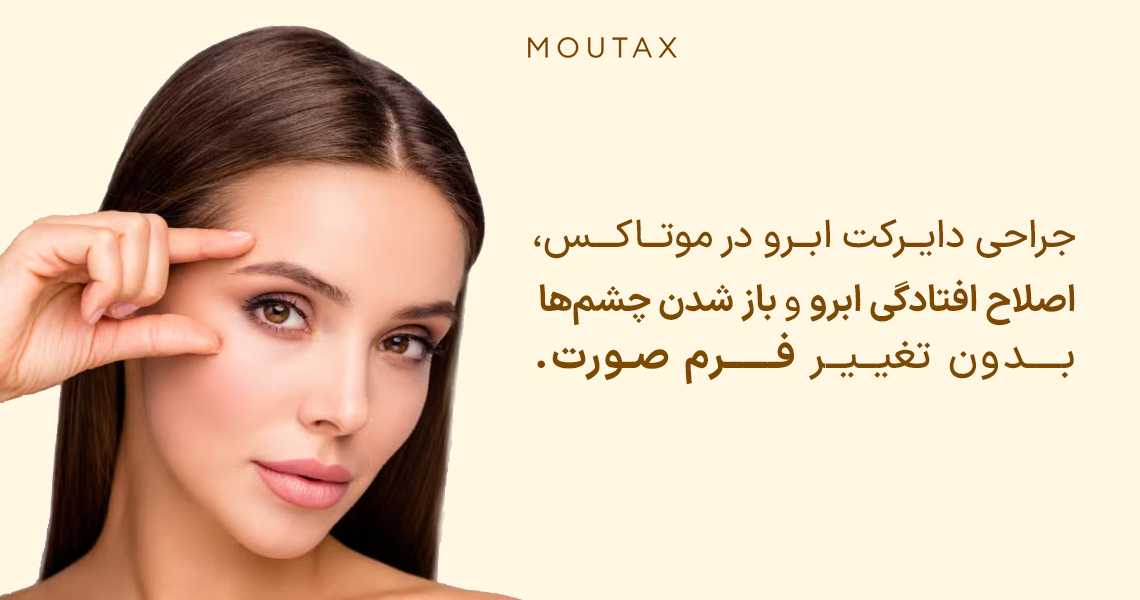 لیفت دایرکت ابرو